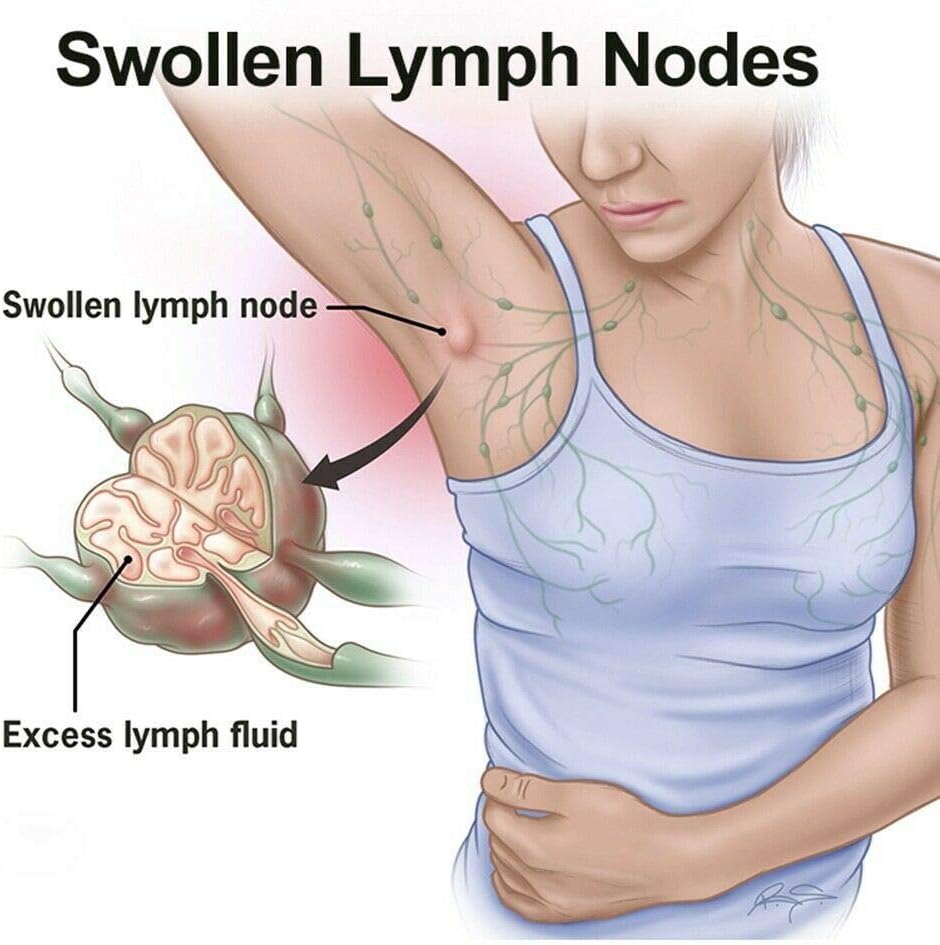 GreenHB Herbal Lymph Care Patch, 10 Pcs, Lymphatic Drainage Patch Neck Lymph Node Anti-Swelling Patch Sticker Lymphatic Drainage with Ginger Oil Help to Remove Swelling and Pain Relief