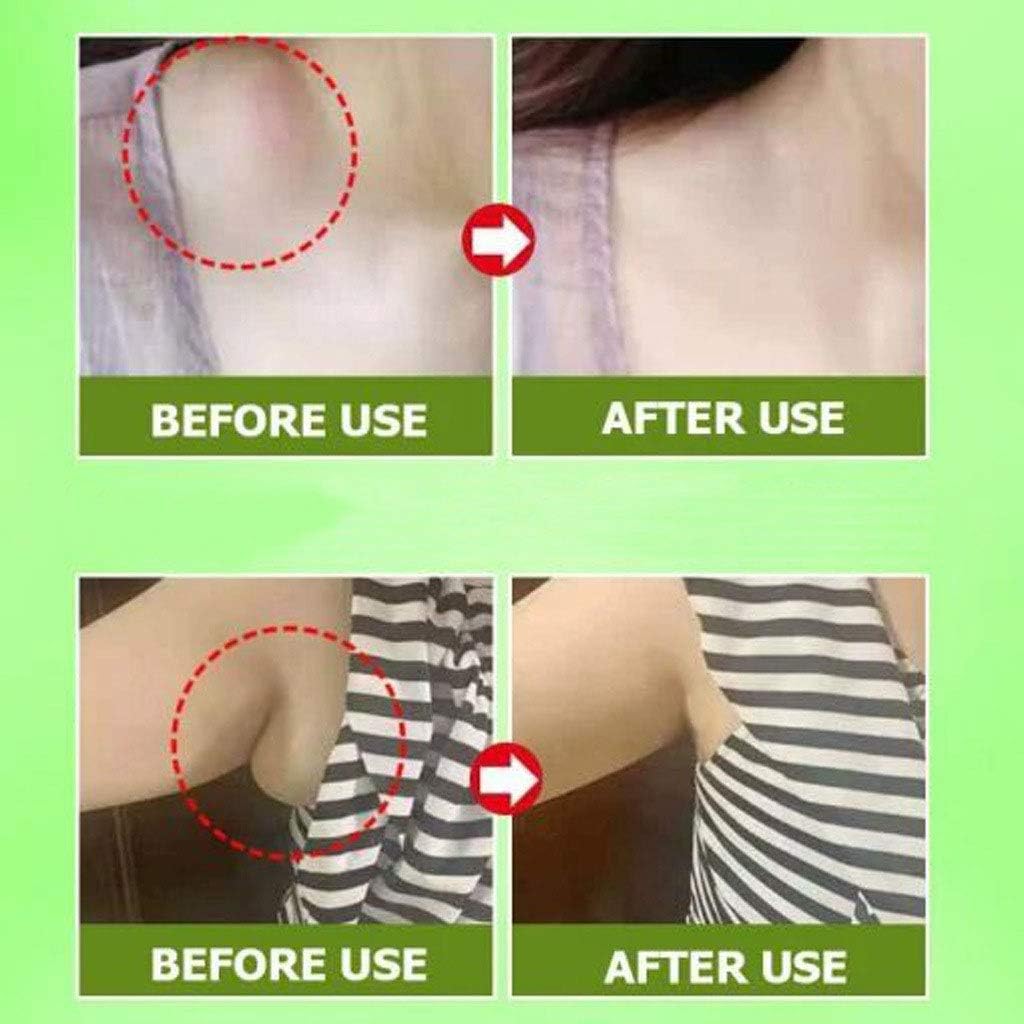 GreenHB Herbal Lymph Care Patch, 20 Pcs, Neck Lymph Node Anti-Swelling Patch Accessory Breasts Sticker Lymphatic Drainage with Ginger Oil Help to Remove Swelling and Pain Relief