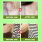 GreenHB Herbal Lymph Care Patch, 10 Pcs, Lymphatic Drainage Patch Neck Lymph Node Anti-Swelling Patch Sticker Lymphatic Drainage with Ginger Oil Help to Remove Swelling and Pain Relief